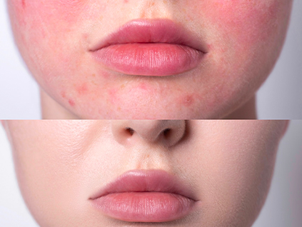 Citlivá pleť eshop